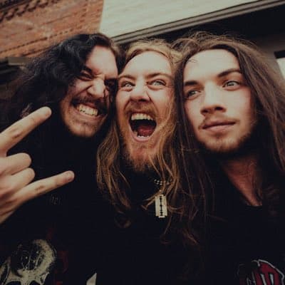 Slackjaw
