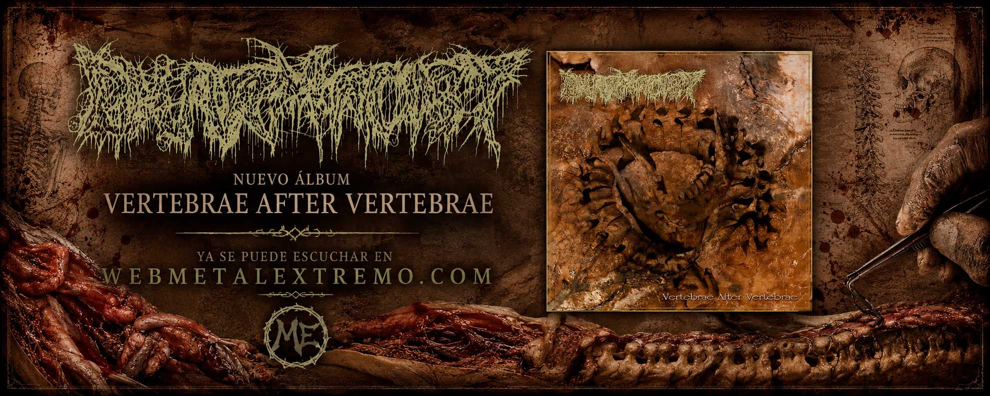 Pharmacist vuelve con "Vertebrae After Vertebrae": pura locura deathgrind